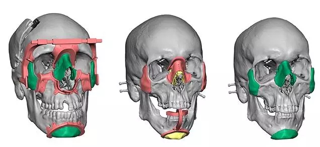 巧妇不再难为无米之炊 3D打印材料大观 