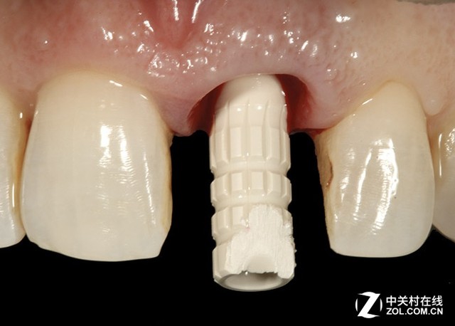 巧妇不再难为无米之炊 3D打印材料大观 